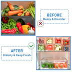 POMEAT 10 Pack Fridge Organizer, Stackable Refrigerator Organizer Bins with Lids, Produce Fruit Storage Containers for Storage Clear for Food, Drinks, Vegetable Storage