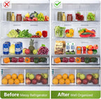 Set Of 10 Refrigerator Pantry Organizer Bins, Clear Plastic Food Storage Bins for Kitchen, Countertops, Cabinets, Fridge, Freezer, Bedrooms, Bathrooms, Fridge Organizer Bins Pantry Storage Containers